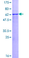 ab162595 on a 12.5% SDS-PAGE stained with Coomassie Blue.