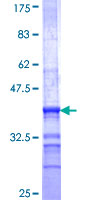 ab162596 on a 12.5% SDS-PAGE stained with Coomassie Blue.