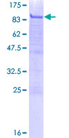 ab158898 on a 12.5% SDS-PAGE stained with Coomassie Blue.