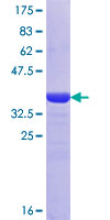 ab164960 on a 12.5% SDS-PAGE stained with Coomassie Blue.