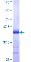 ab153407 on a 12.5% SDS-PAGE stained with Coomassie Blue.
