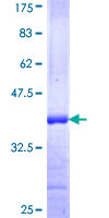 ab153026 on a 12.5% SDS-PAGE stained with Coomassie Blue.