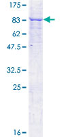 ab159959 on a 12.5% SDS-PAGE stained with Coomassie Blue.