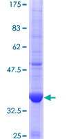 ab159960 on a 12.5% SDS-PAGE stained with Coomassie Blue.