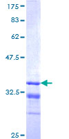 ab161711 on a 12.5% SDS-PAGE stained with Coomassie Blue.