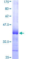 ab161713 on a 12.5% SDS-PAGE stained with Coomassie Blue.