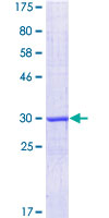 ab159863 on a 12.5% SDS-PAGE stained with Coomassie Blue.