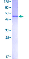 ab159941 on a 12.5% SDS-PAGE stained with Coomassie Blue.