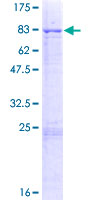 ab153623 on a 12.5% SDS-PAGE stained with Coomassie Blue.
