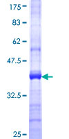 ab153624 on a 12.5% SDS-PAGE stained with Coomassie Blue.