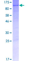 ab158901 on a 12.5% SDS-PAGE stained with Coomassie Blue.