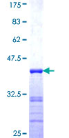 ab161425 on a 12.5% SDS-PAGE stained with Coomassie Blue.