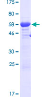 ab160589 on a 12.5% SDS-PAGE stained with Coomassie Blue.