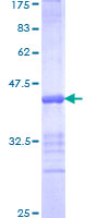 ab160590 on a 12.5% SDS-PAGE stained with Coomassie Blue.