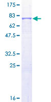 ab158902 on a 12.5% SDS-PAGE stained with Coomassie Blue.