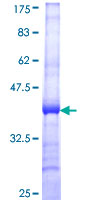 ab158903 on a 12.5% SDS-PAGE stained with Coomassie Blue.