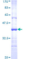 ab163382 on a 12.5% SDS-PAGE stained with Coomassie Blue.