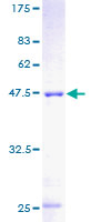 ab160871 on a 12.5% SDS-PAGE stained with Coomassie Blue.