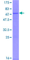 ab158909 on a 12.5% SDS-PAGE stained with Coomassie Blue.