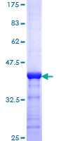 ab158910 on a 12.5% SDS-PAGE stained with Coomassie Blue.