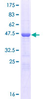 ab164125 on a 12.5% SDS-PAGE stained with Coomassie Blue.