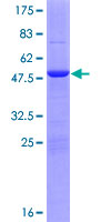 ab165583 on a 12.5% SDS-PAGE stained with Coomassie Blue.