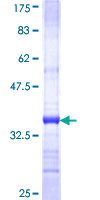 ab165584 on a 12.5% SDS-PAGE stained with Coomassie Blue.