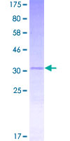 ab158912 on a 12.5% SDS-PAGE stained with Coomassie Blue.