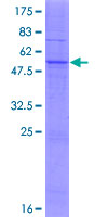 ab164209 on a 12.5% SDS-PAGE stained with Coomassie Blue.