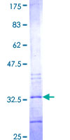 ab164210 on a 12.5% SDS-PAGE stained with Coomassie Blue.