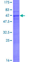 ab166322 on a 12.5% SDS-PAGE stained with Coomassie Blue.