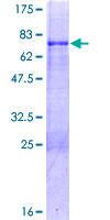 ab166113 on a 12.5% SDS-PAGE stained with Coomassie Blue.