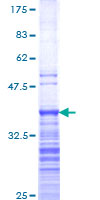 ab166114 on a 12.5% SDS-PAGE stained with Coomassie Blue.
