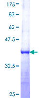 ab162093 on a 12.5% SDS-PAGE stained with Coomassie Blue.