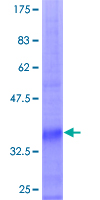 ab164559 on a 12.5% SDS-PAGE stained with Coomassie Blue.