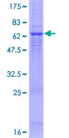 ab158913 on a 12.5% SDS-PAGE stained with Coomassie Blue.