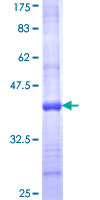ab158914 on a 12.5% SDS-PAGE stained with Coomassie Blue.