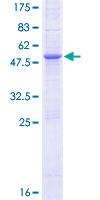 ab163358 on a 12.5% SDS-PAGE stained with Coomassie Blue.