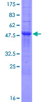 ab163852 on a 12.5% SDS-PAGE stained with Coomassie Blue.