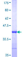ab163853 on a 12.5% SDS-PAGE stained with Coomassie Blue.