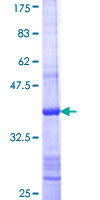 ab162743 on a 12.5% SDS-PAGE stained with Coomassie Blue.
