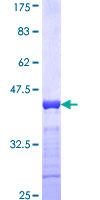ab160870 on a 12.5% SDS-PAGE stained with Coomassie Blue.