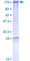 ab160868 on a 12.5% SDS-PAGE stained with Coomassie Blue.