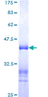 ab160869 on a 12.5% SDS-PAGE stained with Coomassie Blue.