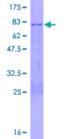 ab164710 on a 12.5% SDS-PAGE stained with Coomassie Blue.