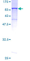 ab158916 on a 12.5% SDS-PAGE stained with Coomassie Blue.