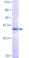 ab158917 on a 12.5% SDS-PAGE stained with Coomassie Blue.