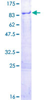 ab165495 on a 12.5% SDS-PAGE stained with Coomassie Blue.