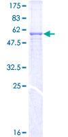 ab163927 on a 12.5% SDS-PAGE stained with Coomassie Blue.