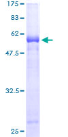 ab158005 on a 12.5% SDS-PAGE stained with Coomassie Blue.